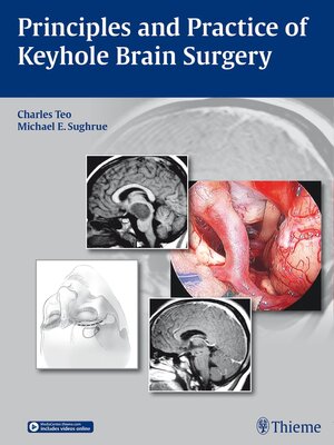 cover image of Principles and Practice of Keyhole Brain Surgery